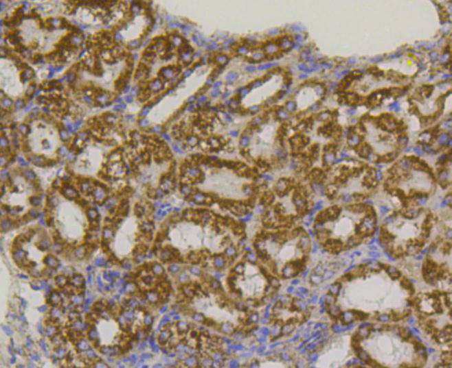 VDAC1 Rabbit mAb