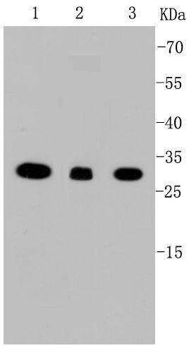 VDAC1 Rabbit mAb