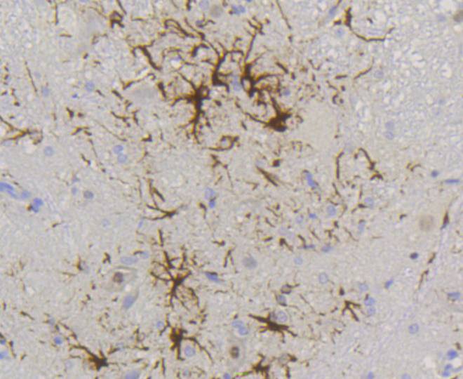 GFAP Rabbit mAb