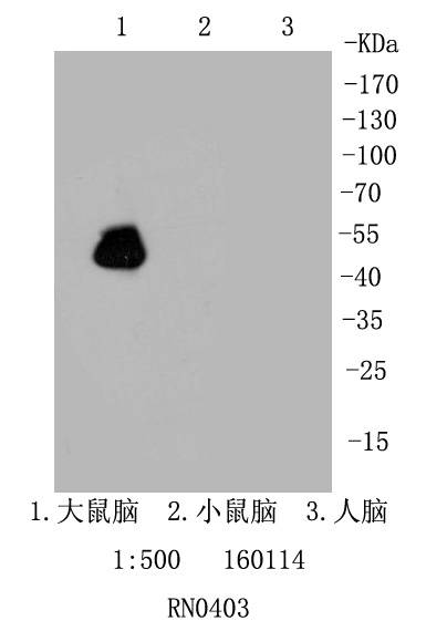 GFAP Rabbit mAb