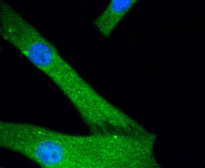 JNK1+JNK2+JNK3 Rabbit mAb