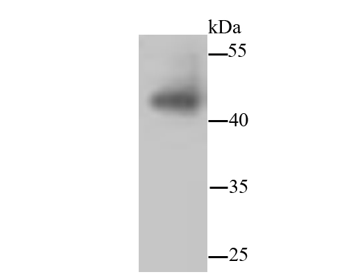 JNK1+JNK2+JNK3 Rabbit mAb