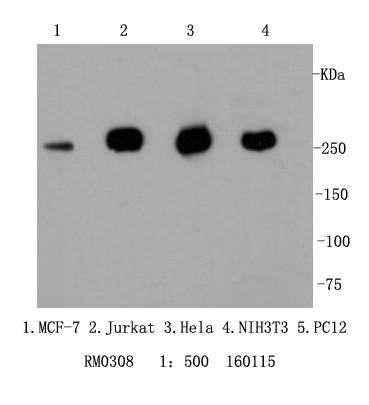 Filamin A Rabbit mAb