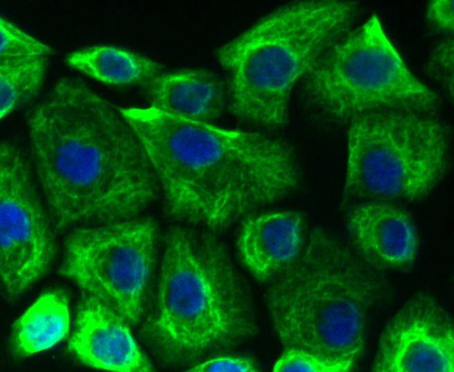 Cytokeratin 19 Rabbit mAb