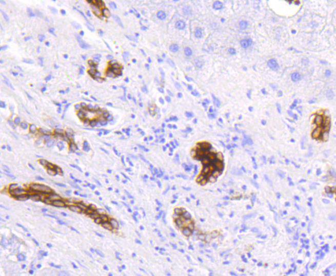 Cytokeratin 19 Rabbit mAb