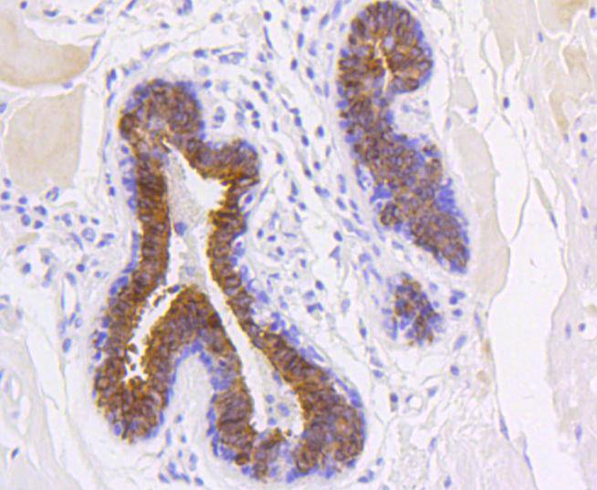 Cytokeratin 19 Rabbit mAb