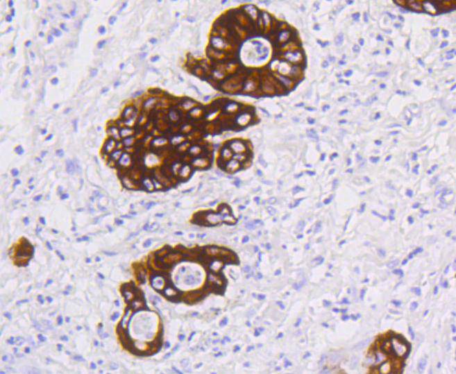 Cytokeratin 19 Rabbit mAb