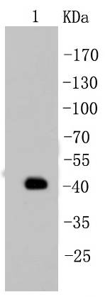 Cytokeratin 19 Rabbit mAb