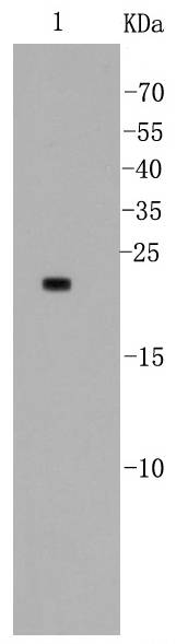 Bad Rabbit mAb