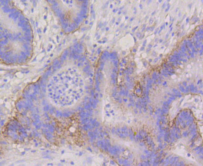 Integrin alpha 6 Rabbit mAb