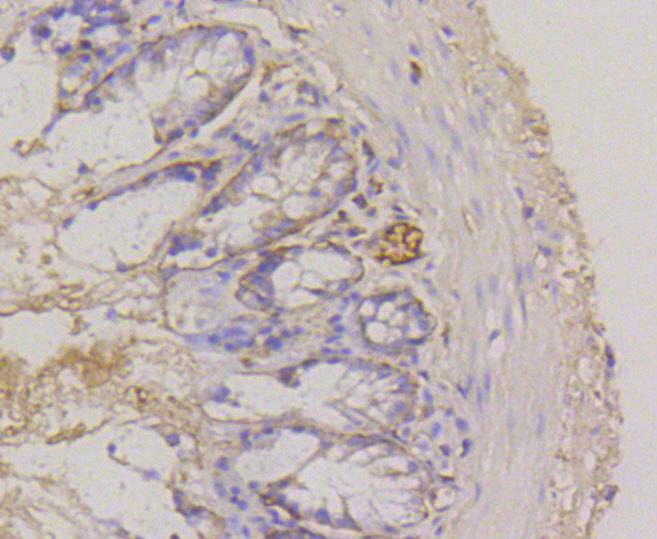 Integrin alpha 6 Rabbit mAb