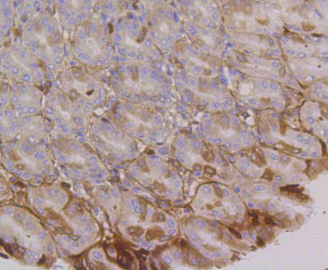 Integrin alpha 6 Rabbit mAb