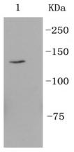 Integrin alpha 6 Rabbit mAb