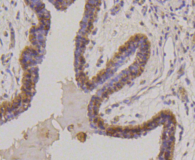 Cytokeratin 17 Rabbit mAb