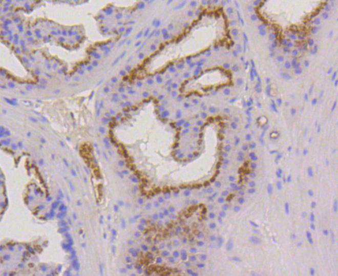 Cytokeratin 17 Rabbit mAb