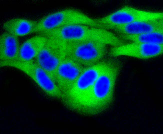 DUSP6 Rabbit mAb