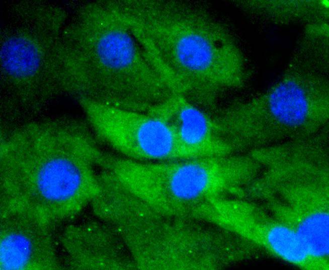 DUSP6 Rabbit mAb