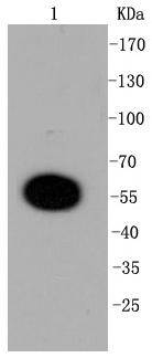 DUSP6 Rabbit mAb