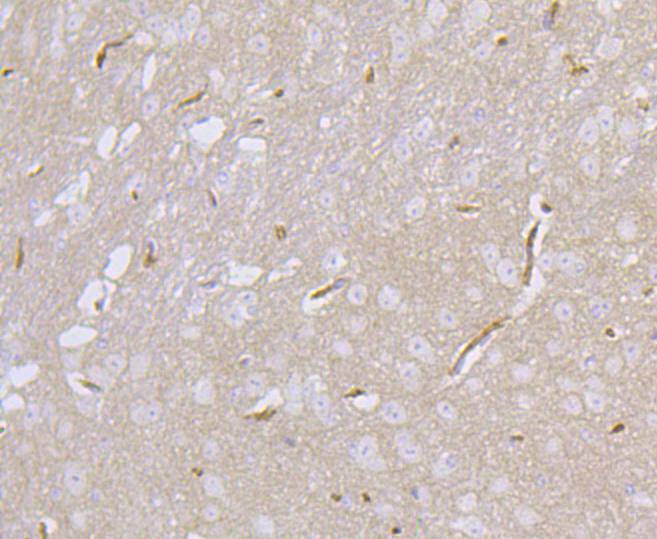 PSD95 Rabbit mAb