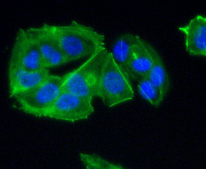 CCR7 Rabbit mAb