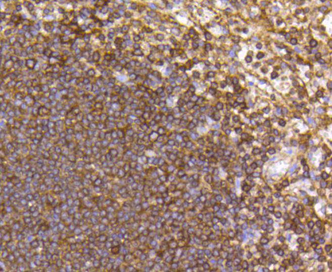 CCR7 Rabbit mAb