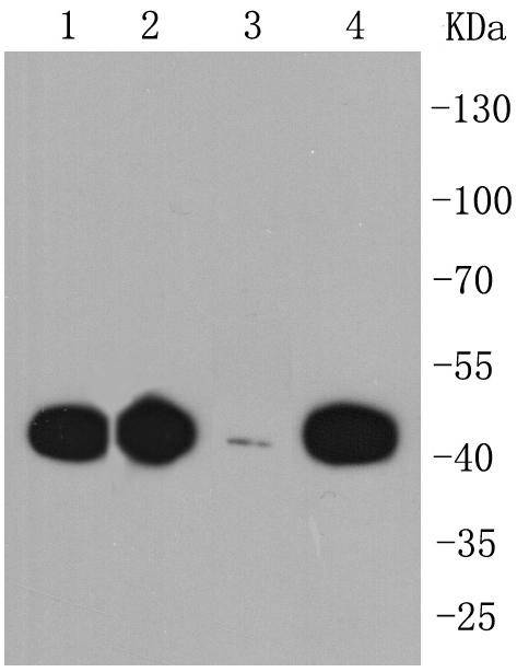 CCR7 Rabbit mAb