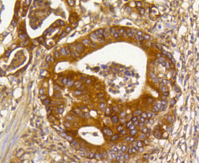 Rho A+B+C Rabbit mAb