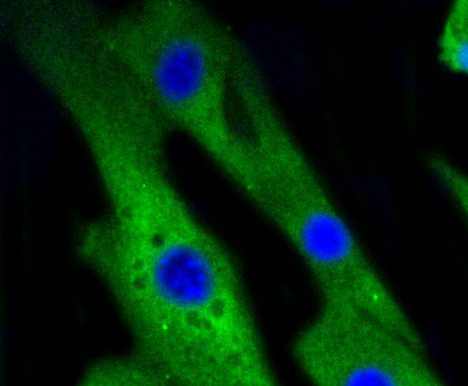 p38 Rabbit mAb