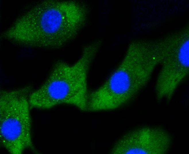 IRF1 Rabbit mAb