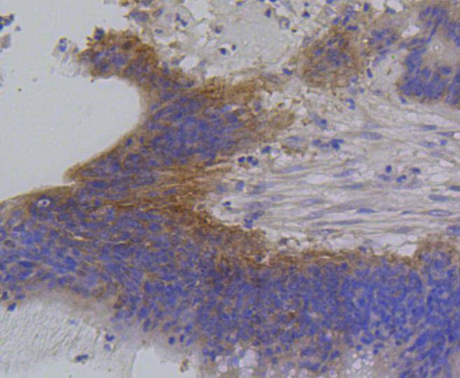 IRF1 Rabbit mAb