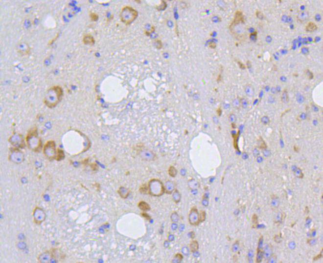 IRF1 Rabbit mAb