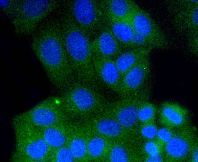 Rab9 Rabbit mAb