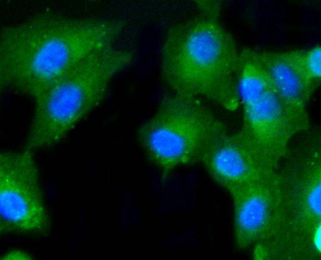 Caspase-2 Rabbit mAb