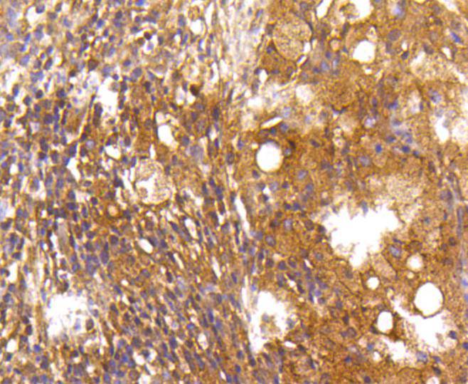 Caspase-2 Rabbit mAb