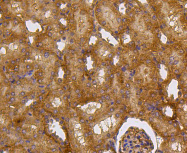 Caspase-2 Rabbit mAb