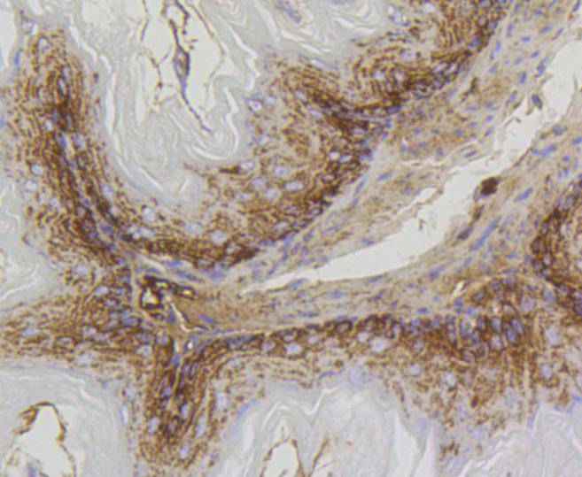 Prohibitin Rabbit mAb