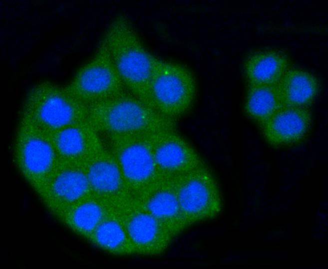 Scavenging Receptor SR-BI Rabbit mAb