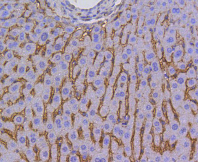 Scavenging Receptor SR-BI Rabbit mAb