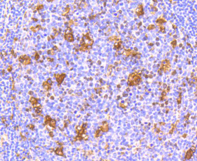 IFNAR1 Rabbit mAb