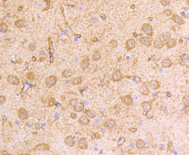 IFNAR1 Rabbit mAb