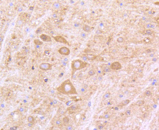 IFNAR1 Rabbit mAb