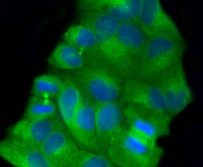 beta Tubulin Rabbit mAb