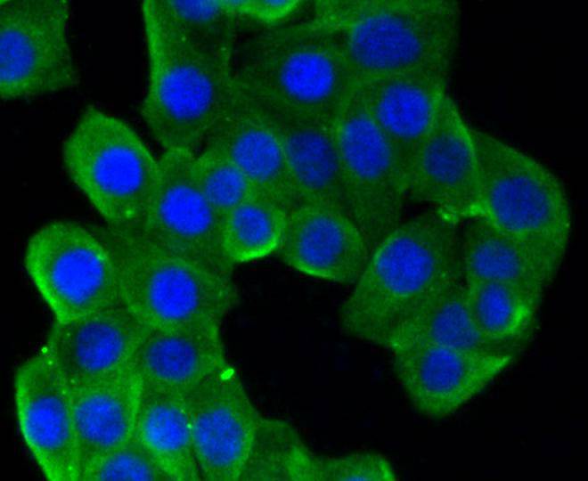 beta Tubulin Rabbit mAb