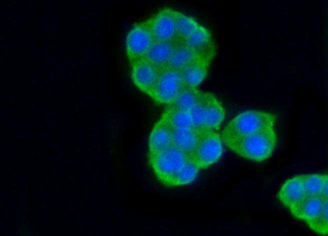 beta Tubulin Rabbit mAb