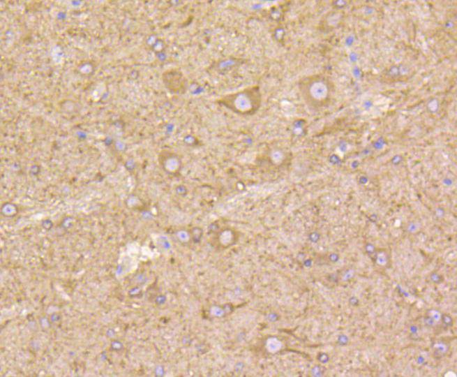 beta Tubulin Rabbit mAb