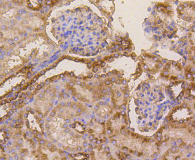 beta Tubulin Rabbit mAb