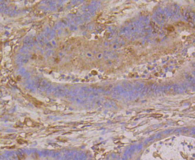 beta Tubulin Rabbit mAb