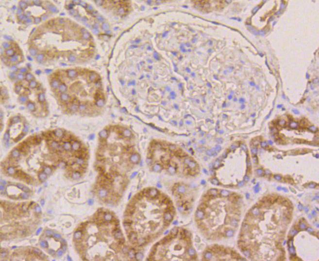 beta Tubulin Rabbit mAb