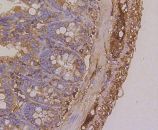 beta Tubulin Rabbit mAb