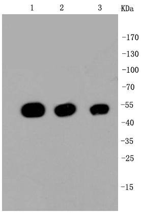 beta Tubulin Rabbit mAb